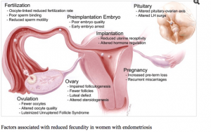 Endo-Infertility